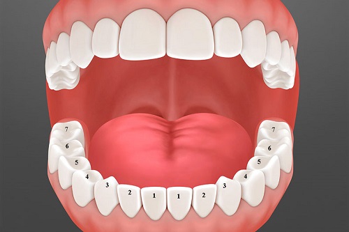 Răng khôn hàm trên bị vỡ - Cách khắc phục 3